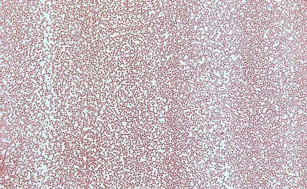 Que los glóbulos rojos sean rojos importa más de lo que parece