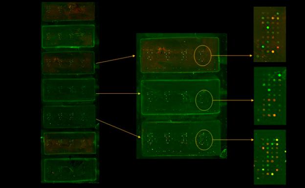 Investigadores del CSIC y USAL diseñan un chip que permite realizar un diagnóstico precoz de patologías articulares